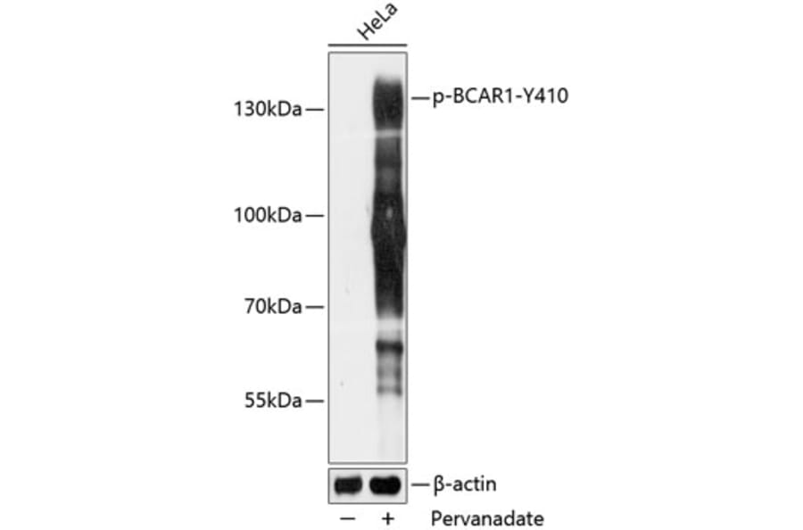 Western Blot - Anti-BCAR1 (phospho Tyr410) Antibody (A88232) - Antibodies.com