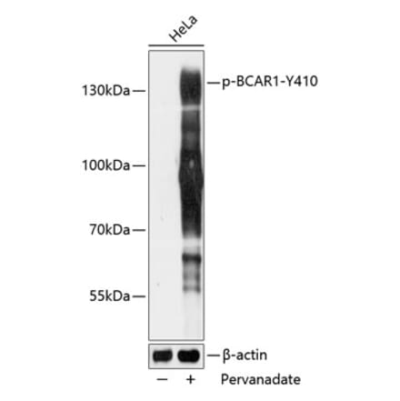 Western Blot - Anti-BCAR1 (phospho Tyr410) Antibody (A88232) - Antibodies.com