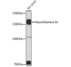 Western Blot - Anti-160 kD Neurofilament Medium Antibody (A88233) - Antibodies.com