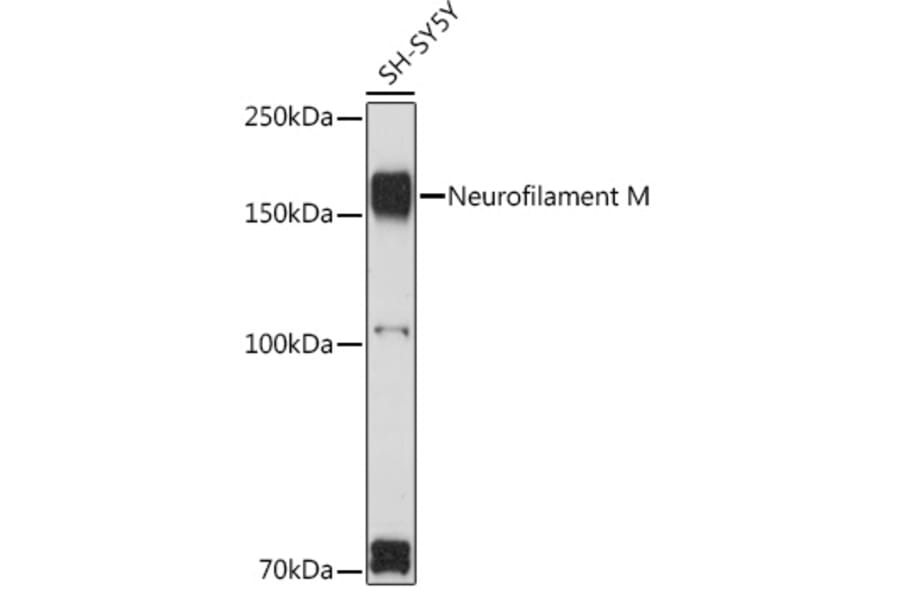 Western Blot - Anti-160 kD Neurofilament Medium Antibody (A88233) - Antibodies.com