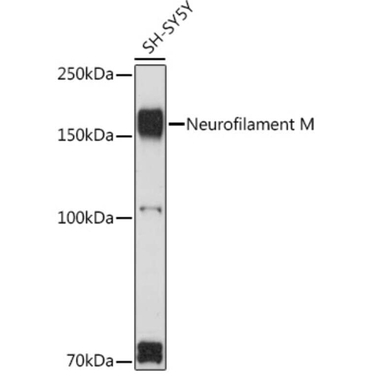 Western Blot - Anti-160 kD Neurofilament Medium Antibody (A88233) - Antibodies.com