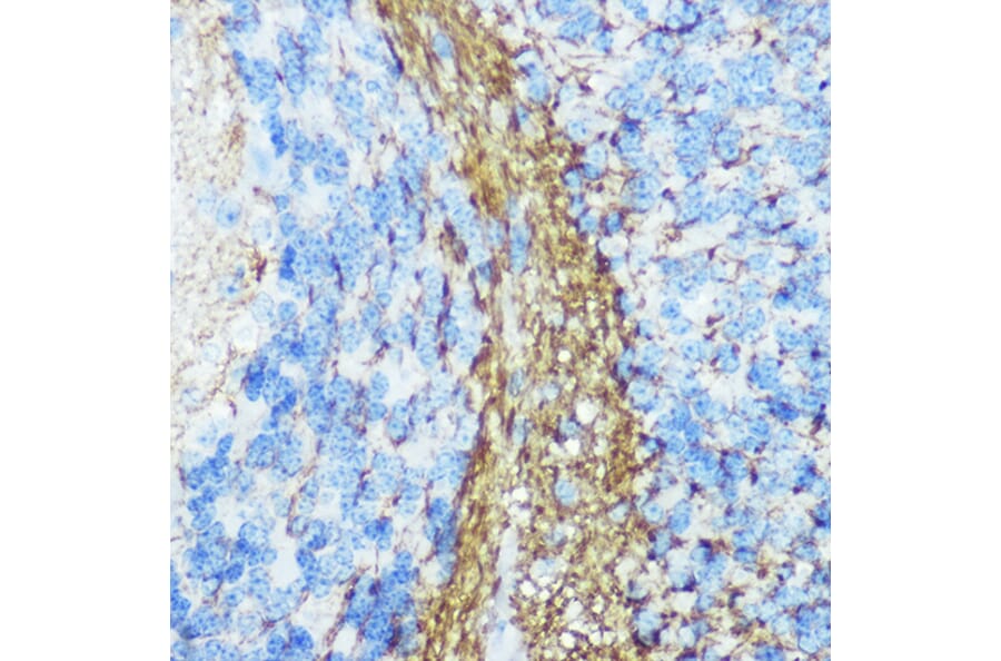 Immunohistochemistry - Anti-160 kD Neurofilament Medium Antibody (A88233) - Antibodies.com