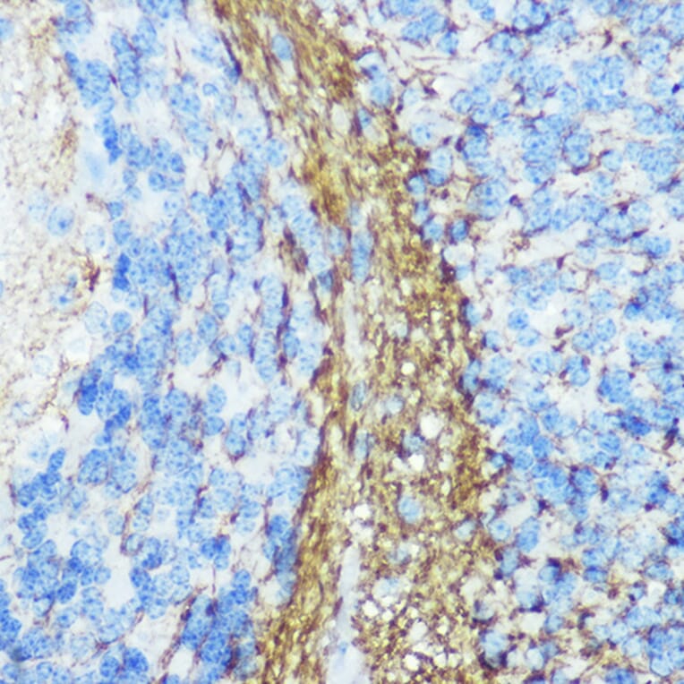 Immunohistochemistry - Anti-160 kD Neurofilament Medium Antibody (A88233) - Antibodies.com