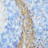 Immunohistochemistry - Anti-160 kD Neurofilament Medium Antibody (A88233) - Antibodies.com