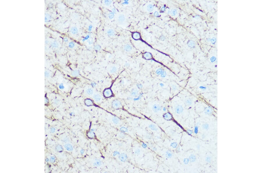 Immunohistochemistry - Anti-160 kD Neurofilament Medium Antibody (A88233) - Antibodies.com