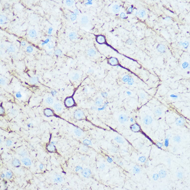Immunohistochemistry - Anti-160 kD Neurofilament Medium Antibody (A88233) - Antibodies.com