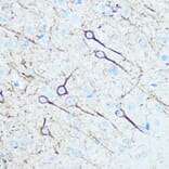 Immunohistochemistry - Anti-160 kD Neurofilament Medium Antibody (A88233) - Antibodies.com