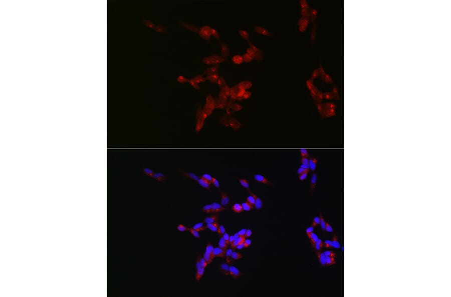 Immunofluorescence - Anti-160 kD Neurofilament Medium Antibody (A88233) - Antibodies.com