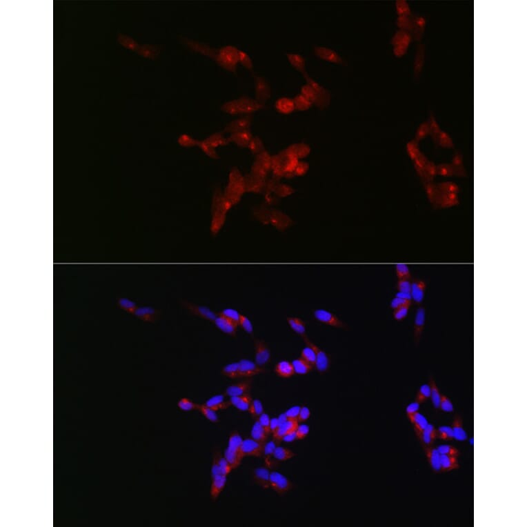 Immunofluorescence - Anti-160 kD Neurofilament Medium Antibody (A88233) - Antibodies.com