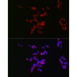 Immunofluorescence - Anti-160 kD Neurofilament Medium Antibody (A88233) - Antibodies.com