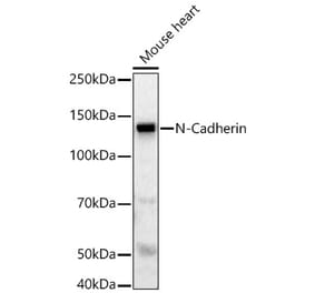 Western Blot - Anti-N Cadherin Antibody (A88234) - Antibodies.com