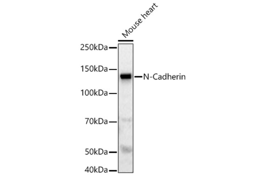 Western Blot - Anti-N Cadherin Antibody (A88234) - Antibodies.com