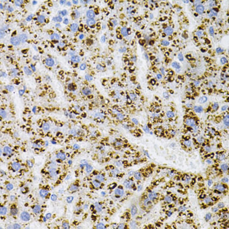 Immunohistochemistry - Anti-TrkA Antibody (A88235) - Antibodies.com