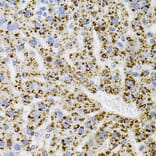 Immunohistochemistry - Anti-TrkA Antibody (A88235) - Antibodies.com