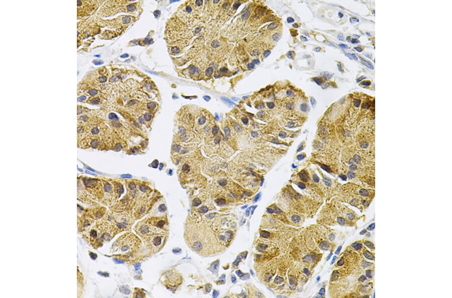 Immunohistochemistry - Anti-TrkA Antibody (A88235) - Antibodies.com
