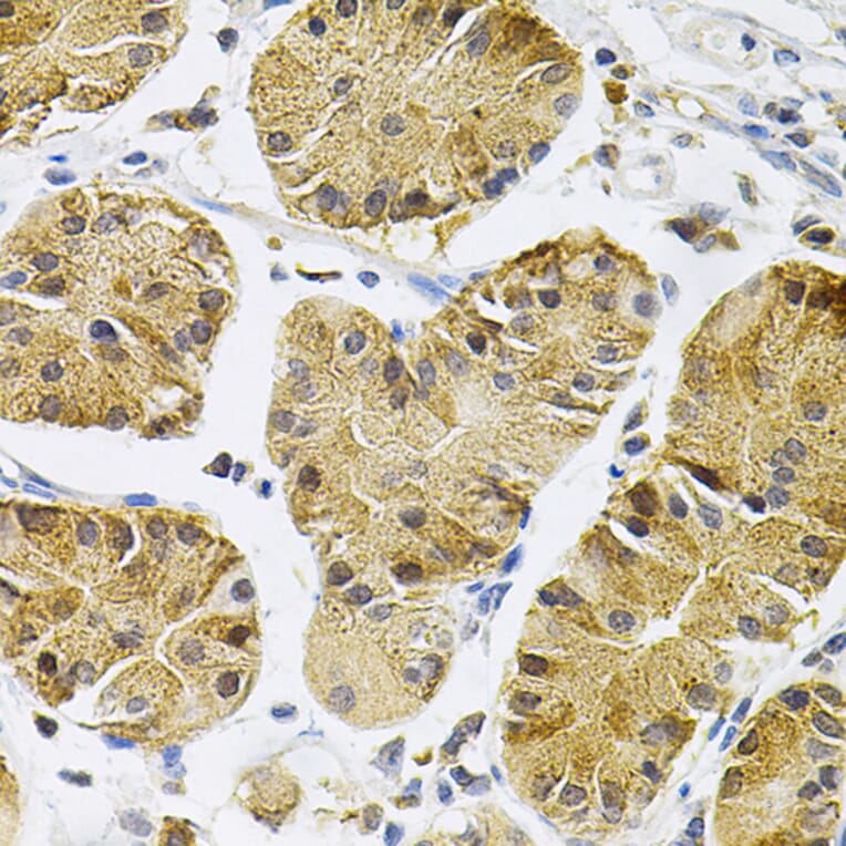 Immunohistochemistry - Anti-TrkA Antibody (A88235) - Antibodies.com