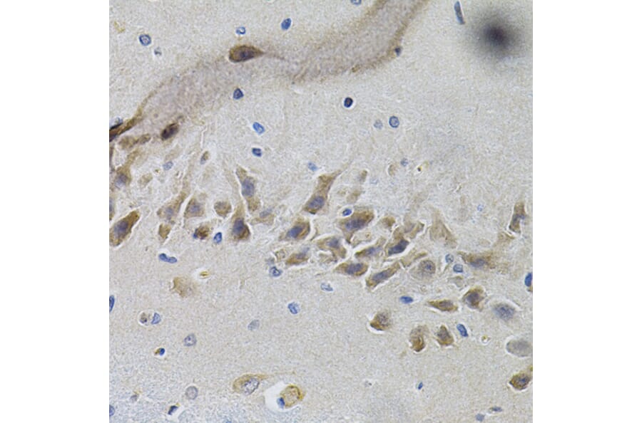 Immunohistochemistry - Anti-TrkA Antibody (A88235) - Antibodies.com