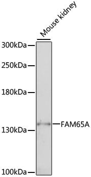 Western blot analysis of extracts of mouse kidney, using Anti-FAM65A Antibody (A16570) at 1:1,000 dilution.
Secondary antibody: Goat Anti-Rabbit IgG (H+L) (HRP) (AS014) at 1:10,000 dilution.
Lysates / proteins: 25µg per lane.
Blocking buffer: 3% non-fat dry milk in TBST.
Detection: ECL Basic Kit (RM00020).
Exposure time: 1s.