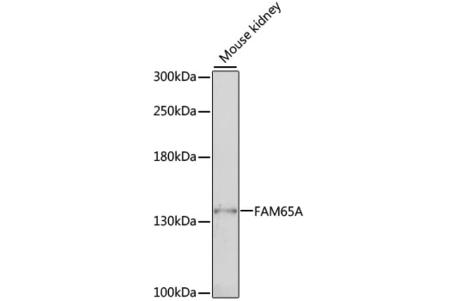 Western Blot - Anti-FAM65A Antibody (A88236) - Antibodies.com