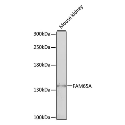 Western Blot - Anti-FAM65A Antibody (A88236) - Antibodies.com