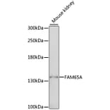 Western Blot - Anti-FAM65A Antibody (A88236) - Antibodies.com