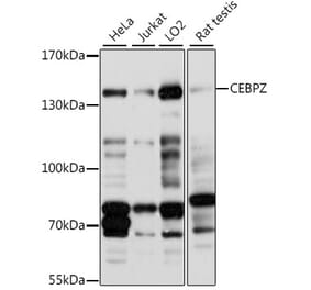 Western Blot - Anti-CBF Antibody (A88237) - Antibodies.com