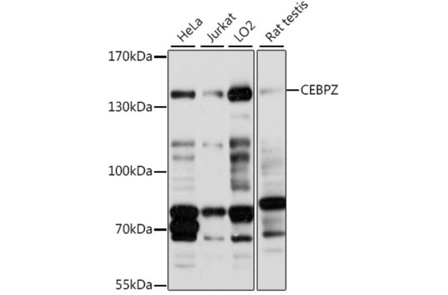 Western Blot - Anti-CBF Antibody (A88237) - Antibodies.com
