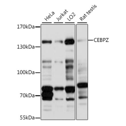 Western Blot - Anti-CBF Antibody (A88237) - Antibodies.com