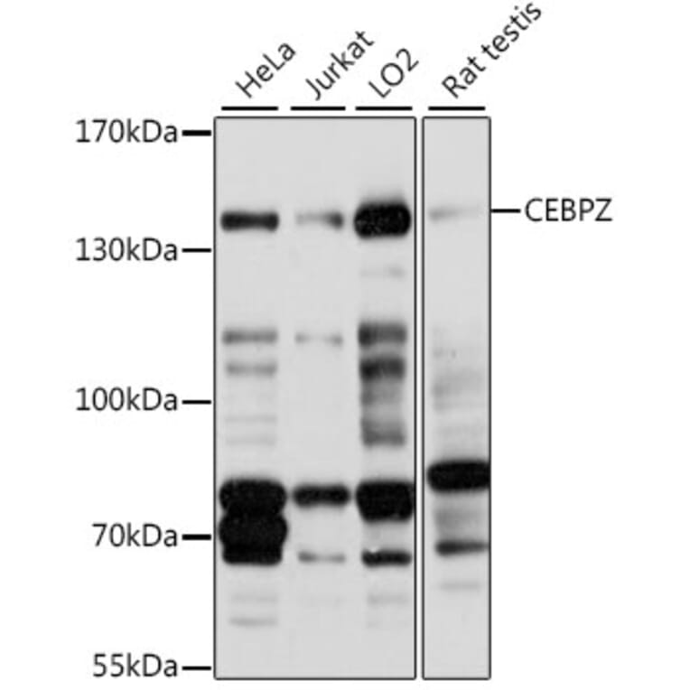 Western Blot - Anti-CBF Antibody (A88237) - Antibodies.com