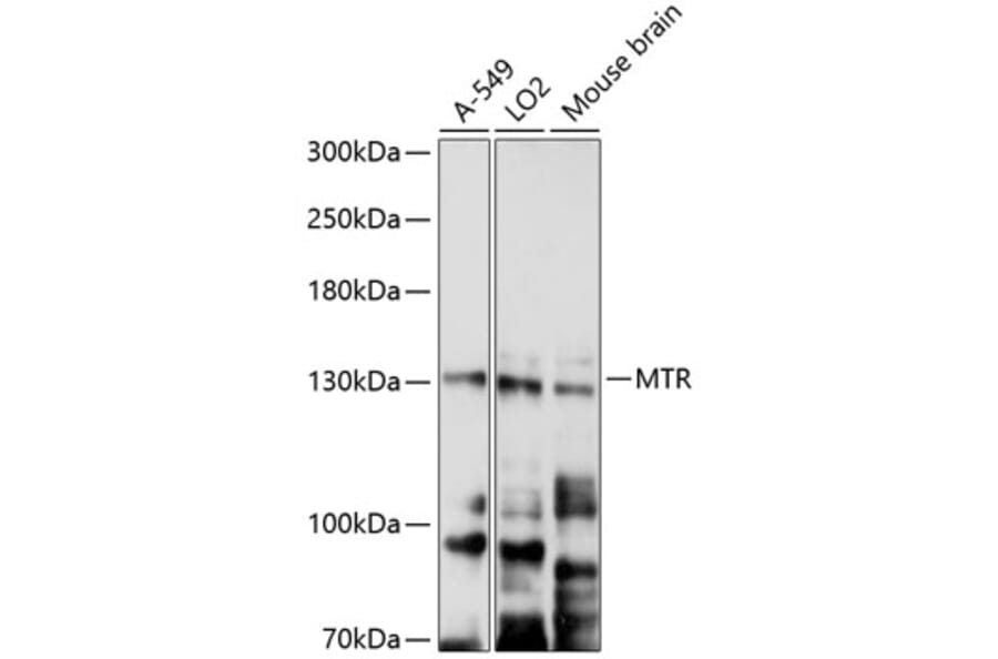 Western Blot - Anti-MTR Antibody (A9731) - Antibodies.com