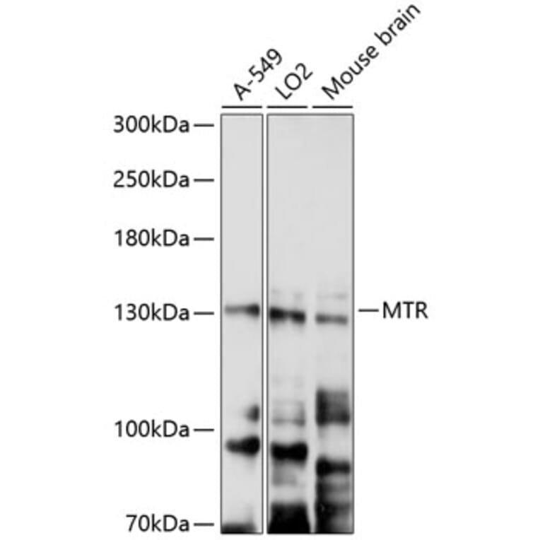Western Blot - Anti-MTR Antibody (A9731) - Antibodies.com