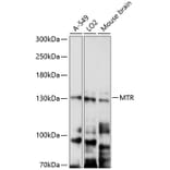 Western Blot - Anti-MTR Antibody (A9731) - Antibodies.com
