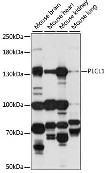 Western blot analysis of extracts of various cell lines, using Anti-PLCL1 Antibody (A15302) at 1:1,000 dilution.
Secondary antibody: Goat Anti-Rabbit IgG (H+L) (HRP) (AS014) at 1:10,000 dilution.
Lysates / proteins: 25µg per lane.
Blocking buffer: 3% non-fat dry milk in TBST.
Detection: ECL Basic Kit (RM00020).
Exposure time: 30s.