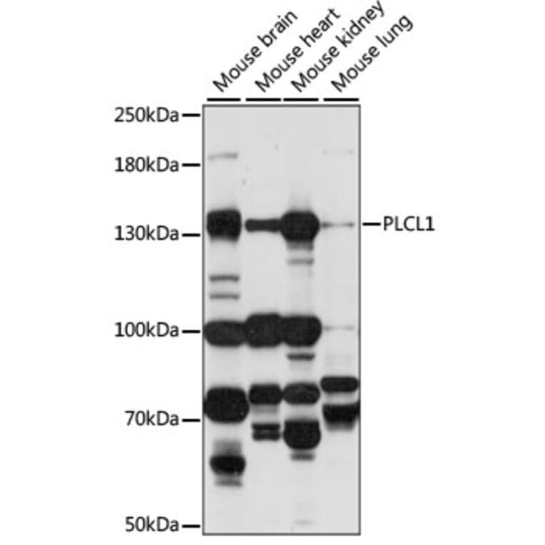 Western Blot - Anti-PLCL1 Antibody (A88239) - Antibodies.com