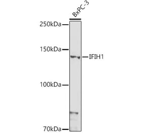 Western Blot - Anti-MDA5 Antibody (A88241) - Antibodies.com