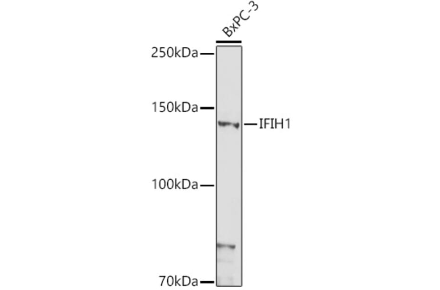 Western Blot - Anti-MDA5 Antibody (A88241) - Antibodies.com