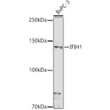 Western Blot - Anti-MDA5 Antibody (A88241) - Antibodies.com