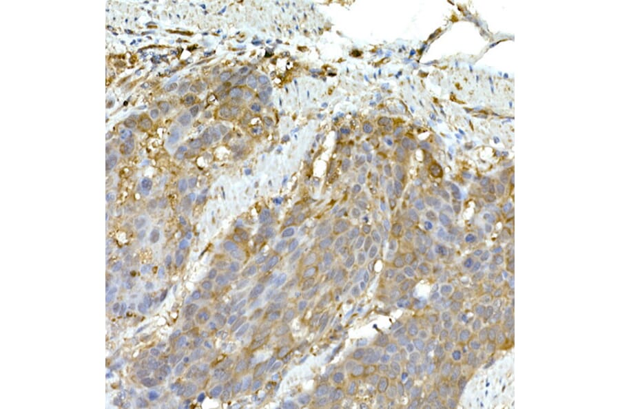Immunohistochemistry - Anti-MDA5 Antibody (A88241) - Antibodies.com