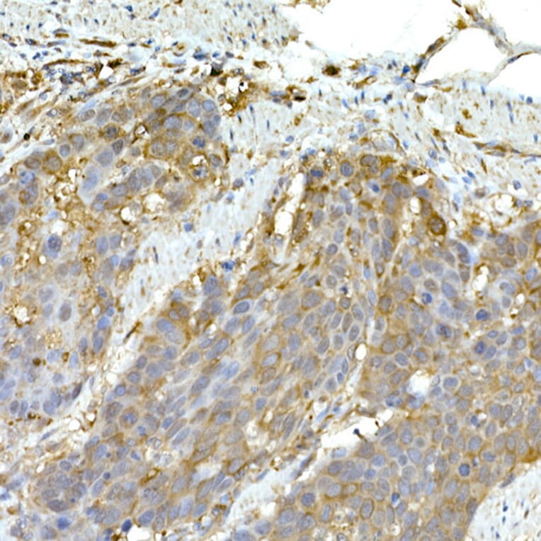 Immunohistochemistry - Anti-MDA5 Antibody (A88241) - Antibodies.com