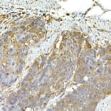 Immunohistochemistry - Anti-MDA5 Antibody (A88241) - Antibodies.com