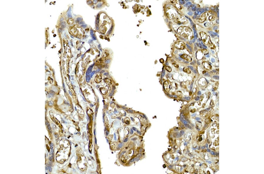 Immunohistochemistry - Anti-MDA5 Antibody (A88241) - Antibodies.com