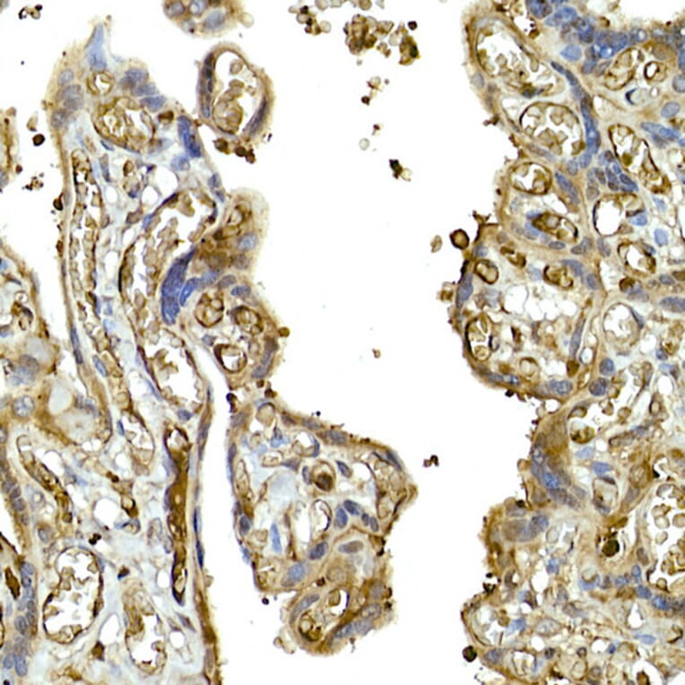Immunohistochemistry - Anti-MDA5 Antibody (A88241) - Antibodies.com