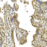 Immunohistochemistry - Anti-MDA5 Antibody (A88241) - Antibodies.com