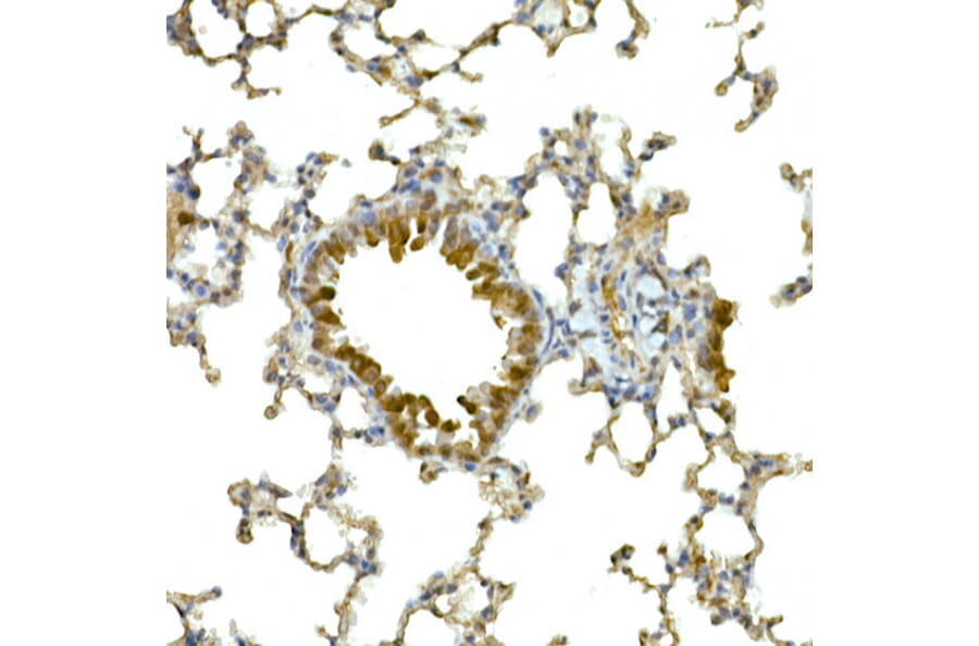 Immunohistochemistry - Anti-MDA5 Antibody (A88241) - Antibodies.com