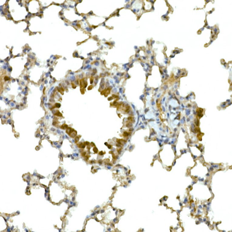 Immunohistochemistry - Anti-MDA5 Antibody (A88241) - Antibodies.com