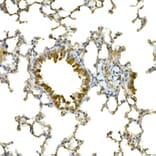 Immunohistochemistry - Anti-MDA5 Antibody (A88241) - Antibodies.com