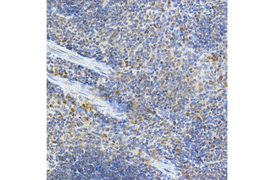 Immunohistochemistry - Anti-MDA5 Antibody (A88241) - Antibodies.com