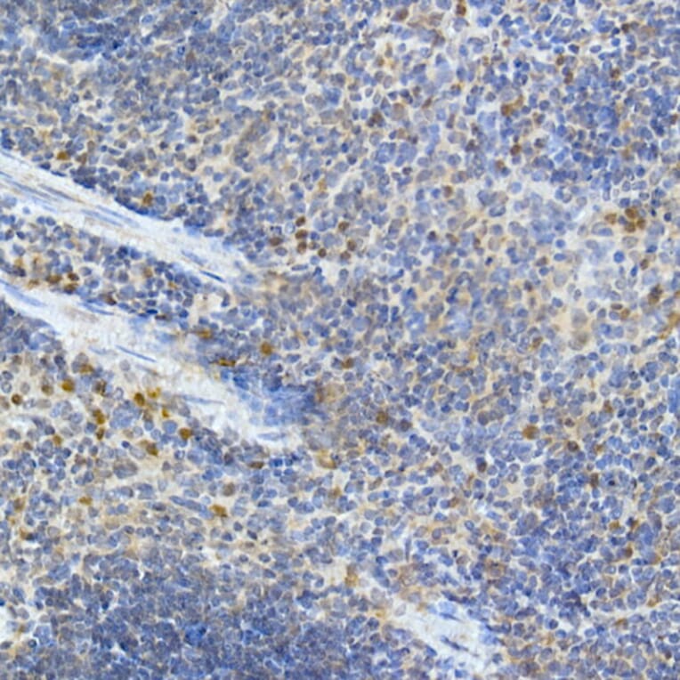Immunohistochemistry - Anti-MDA5 Antibody (A88241) - Antibodies.com