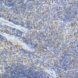 Immunohistochemistry - Anti-MDA5 Antibody (A88241) - Antibodies.com