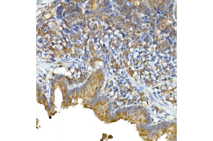 Immunohistochemistry - Anti-MDA5 Antibody (A88241) - Antibodies.com